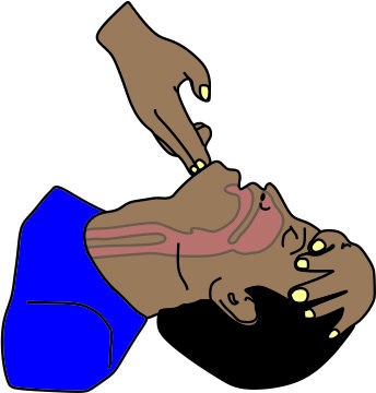 A.            Airway