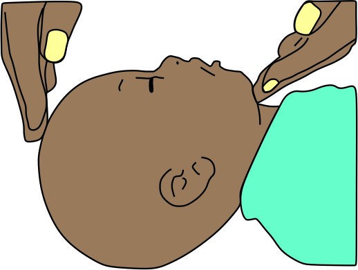 A.	Airway